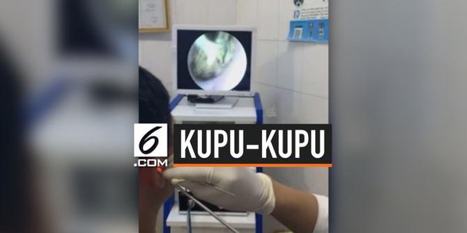 VIDEO: Kupu-Kupu Bersarang di Telinga Pria Vietnam 3 Hari