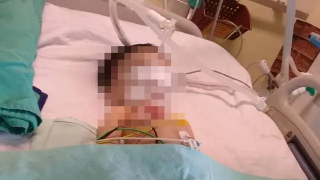 Babysitter Lalai, Nasib Balita yang Jatuh dari Ayunan Berakhir Memilukan