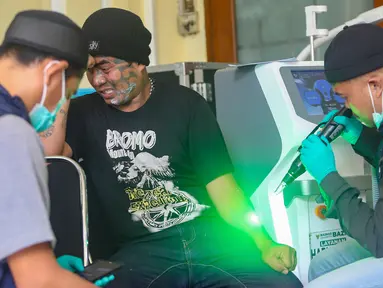 Petugas melakukan proses hapus tato pada tubuh peserta di Masjid Sunda Kelapa, Jakarta, Selasa (24/2/2026). Sejak pertama kali dilaksanakan, ribuan orang telah mendapat manfaat dari program hapus tato gratis yang digelar Badan Amil Zakat Nasional (Baznas)/Bazis Provinsi DKI Jakarta. (merdeka.com/Arie Basuki)