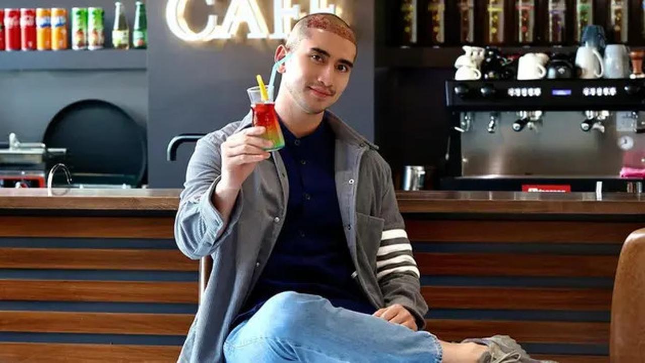 Keputusan Verrell untuk melakukan transplantasi rambut di Turki menarik perhatian netizen.