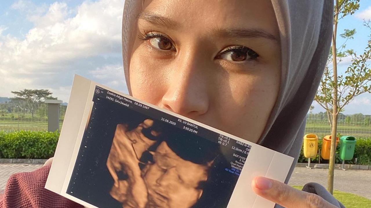 Zaskia Adya Mecca. (Foto: Instagram @zaskiadyamecca)