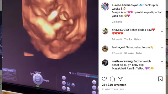 Unggahan Aurel Hermansyah. (Foto: Dok. Instagram @aurelie.hermansyah)