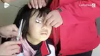 Upaya penyelamatan kelopak mata seorang wanita yang terjebak resleting. Proses penyelamatan berlangsung selama 40 menit.
