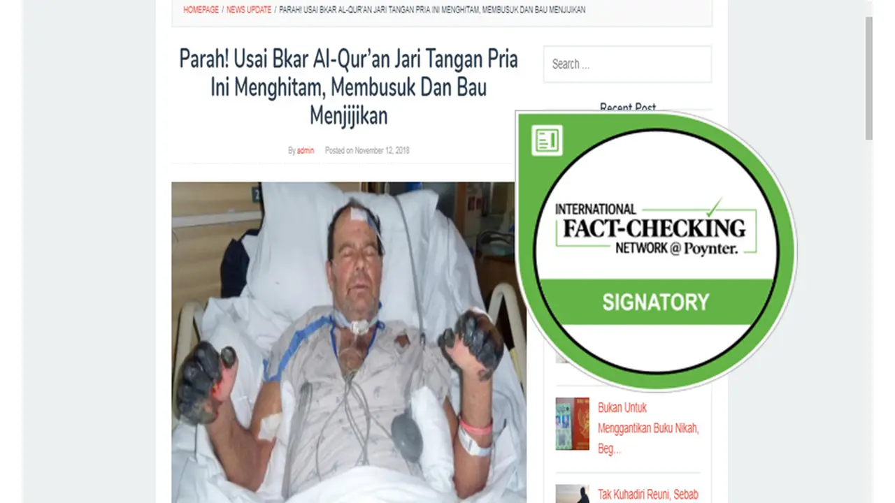 [Cek Fakta] Tangan Pria Gosong, Karena Bakar Alquran?