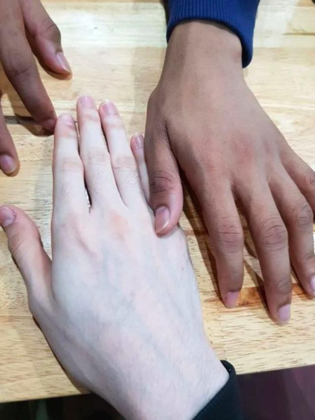 Viral Krim Pemutih yang Hasilnya Bikin Warganet Bergidik