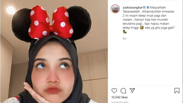 Zaskia Sungkar (Foto: Instagram/@zaskiasungkar15)