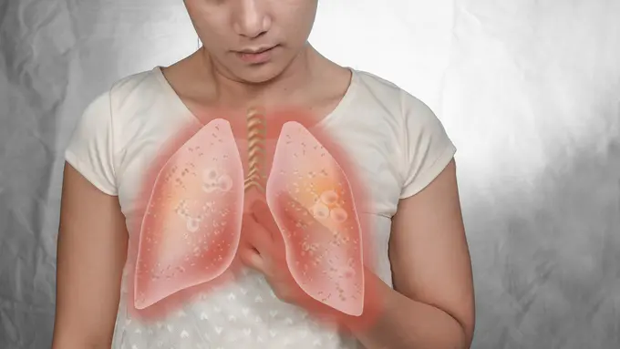 Ilustrasi EBUS (Endobronchial Ultrasound) dalam Deteksi dan Penatalaksanaan Kanker Paru-Paru (phugunfire/shutterstock)