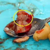 Sebuah foto menghebohkan diunggah netizen. Dia menemukan kaki tikus dalam kemasan sosis, yeuh!