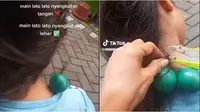 Tali Lato-lato Nyangkut di Leher dan Rambut Bocah Ini Bikin Heboh, Kok Bisa Ya