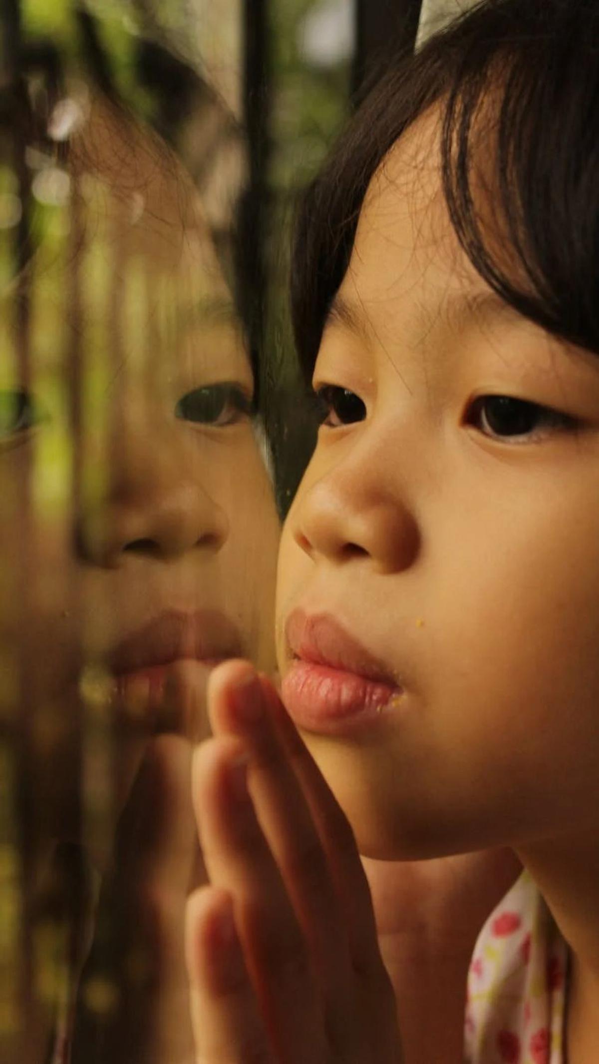 Tidak hanya itu, ada juga kasus langka di mana penyakit Kawasaki bisa menyebabkan bibir merah, kering, pecah-pecah, dan bahkan mengeluarkan darah. Penyakit ini umumnya menyerang anak-anak di bawah 14 tahun dan memerlukan perhatian medis.