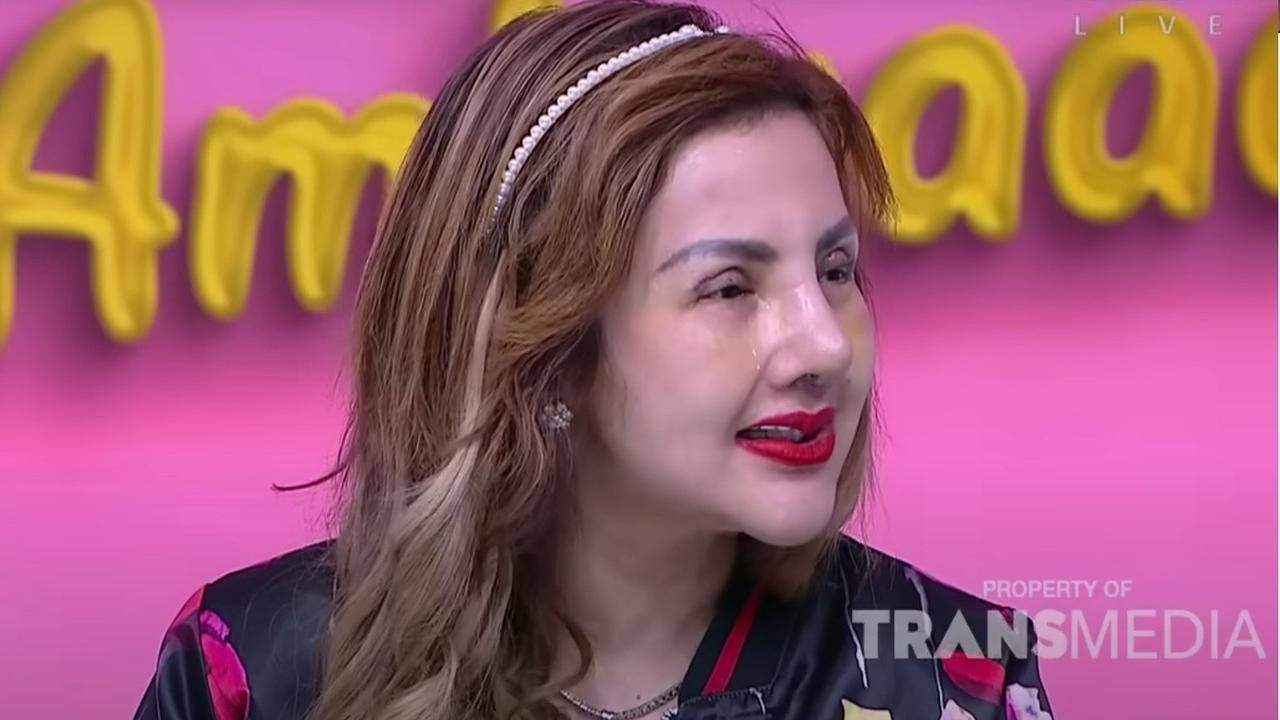 Potret Barbie Kumalasari Oplas Ke-9 Kalinya, Keluarkan Uang Ratusan Juta & Wajah Terbarunya Jadi Sorotan