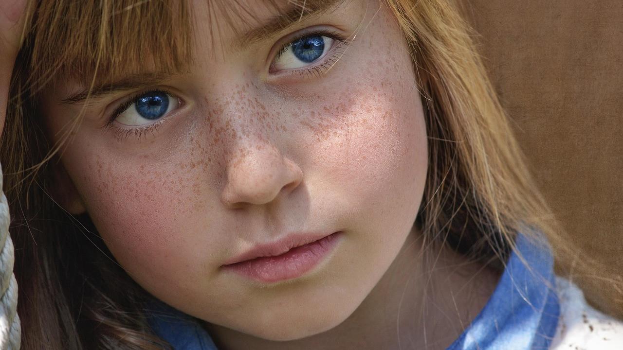 ilustrasi wajah freckles