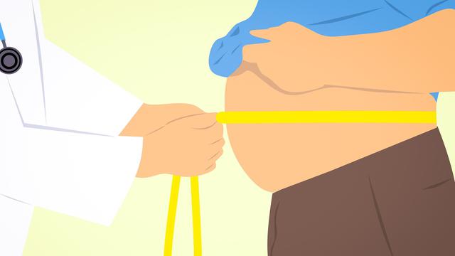 Penyebab Perut Buncit.