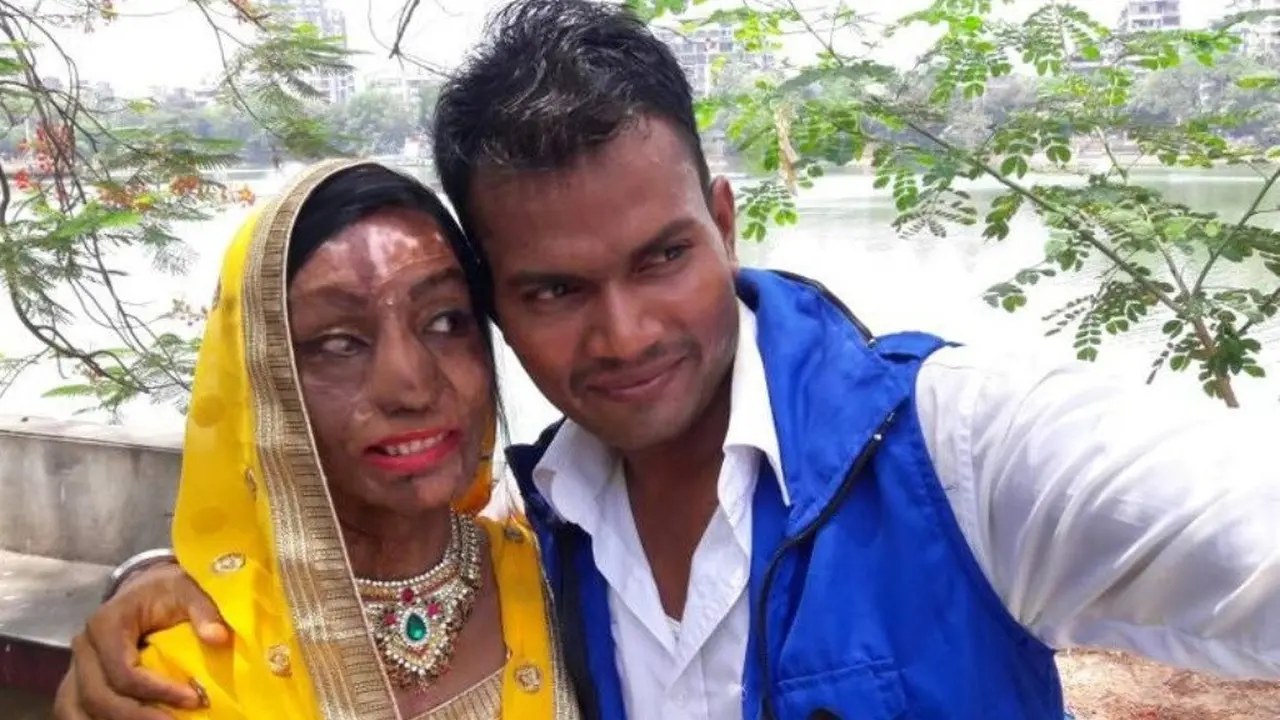 Lalita Ben Bansi, korban penyiraman air keras di India dipersunting pria pujaan
