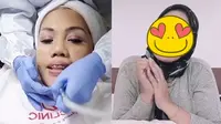 Perawatan Pengencangan Kulit Wajah, Ini 6 Potret Terbaru Elly Sugigi Semakin Tirus