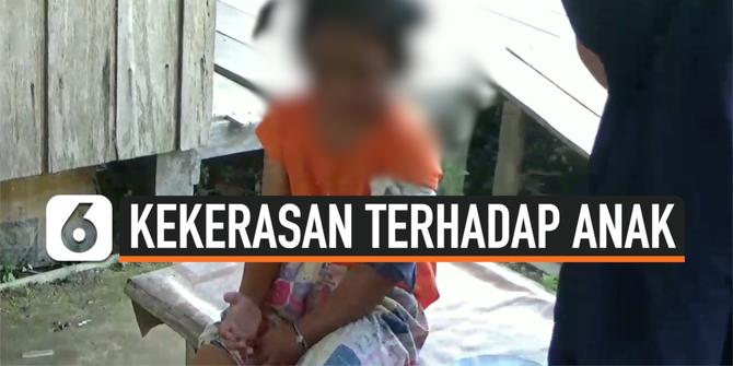 VIDEO: Bocah 6 Tahun Babak Belur dan Patah Tulang Disiksa Ibu Kandung dan Kekasihnya