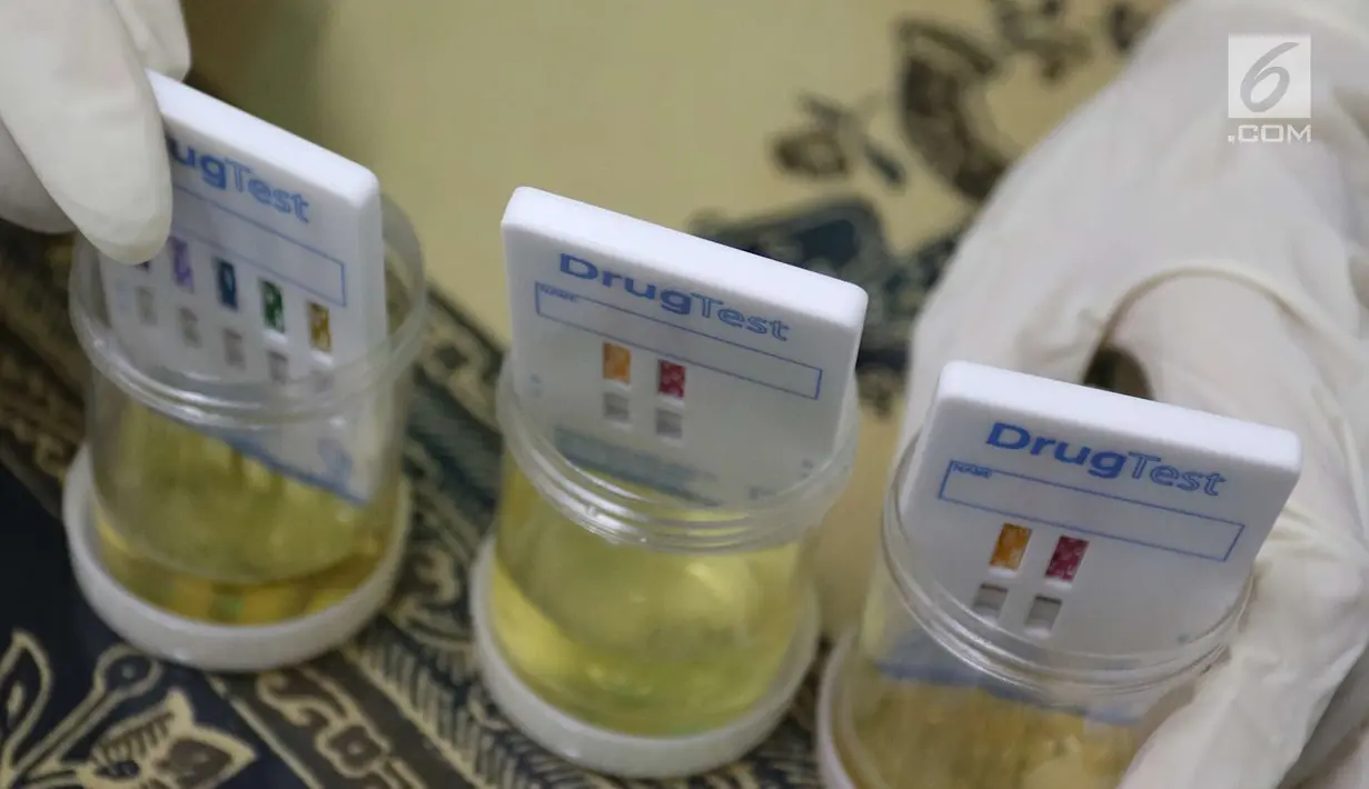 Petugas memeriksa urine sopir bus di Terminal Kampung Rambutan, Jakarta, Jumat (8/6). Pemeriksaan bertujuan memastikan kondisi kesehatan sopir agar tetap baik dalam mengoperasikan kendaraan yang mengangkut pemudik. (Liputan6.com/Immanuel Antonius)