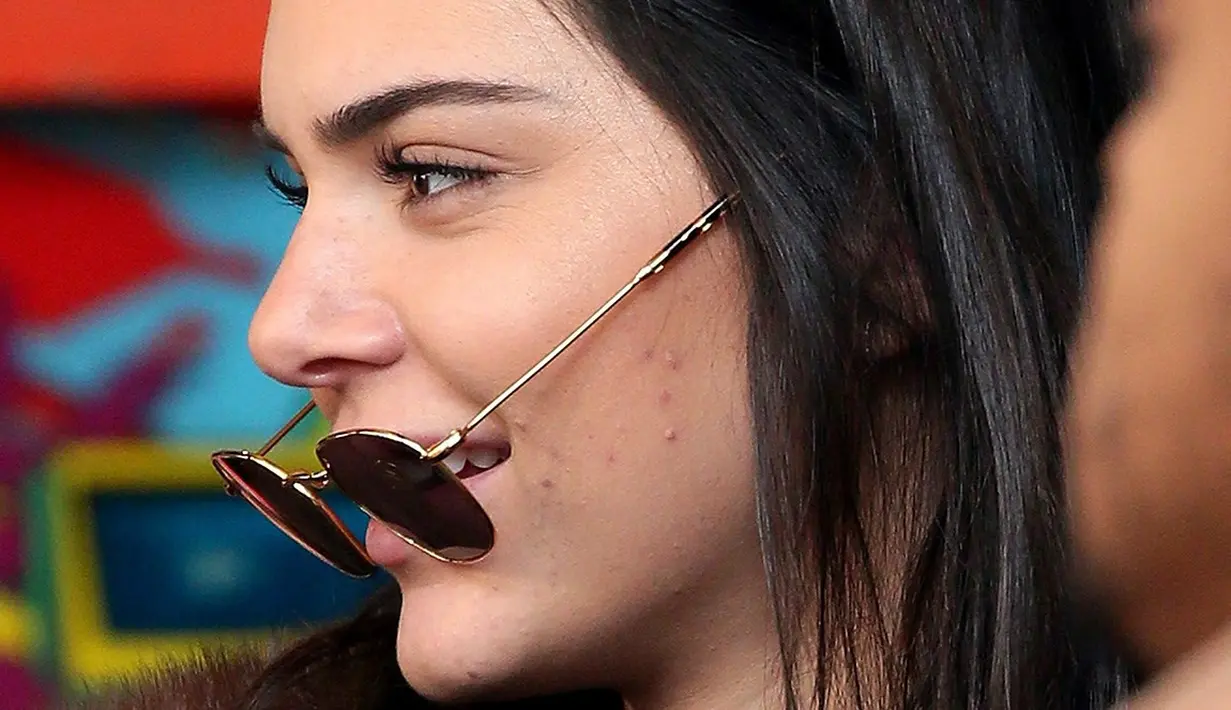 Kakak Kylie Jenner tersebut seakan menolak untuk menutupi wajahnya dengan makeup. Ia pun tampil percaya diri dengan wajah jerawatnya. (beautycrew)