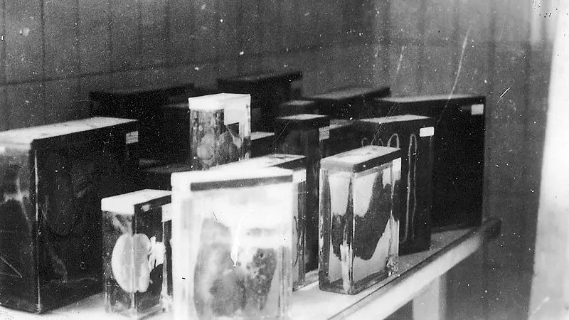 Koleksi organ dalam para tahanan kamp konsentrasi Nazi di Buchenwald (Wikipedia/Creative Commons)
