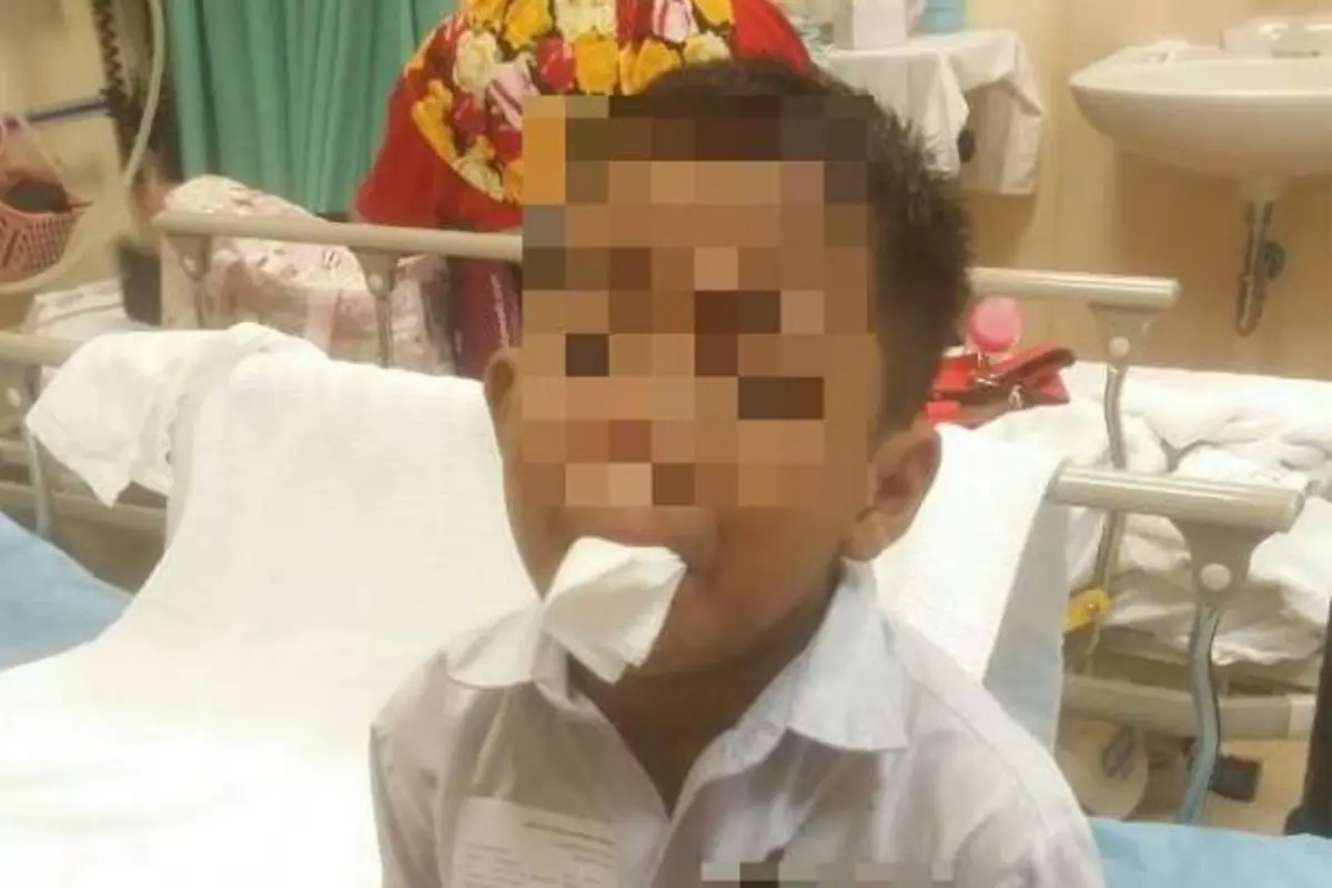 Takut Ditinju Lagi, Bocah Ini Nekat Potong Lidah