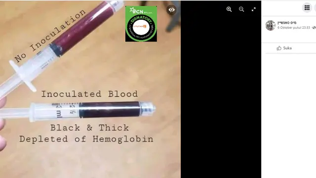 Cek Fakta Liputan6.com menelusuri klaim foto penampakan warna darah yang belum dan sudah divaksin Covid-19