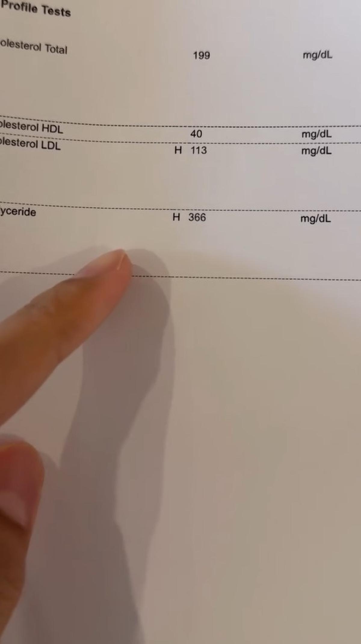 7 Potret Krisjiana Masuk Rumah Sakit, Makan Tak Sehat & Kolesterol Tinggi Hingga Radang Pankreas, Pembesaran Hati & Batu Empedu