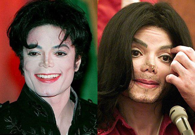 Penampilan Michael Jackson pada tahun 1995 dan 2002, terlihat selotip pada hidung Michael yang bocor(kanan)| foto: copyright dailymail.co.uk