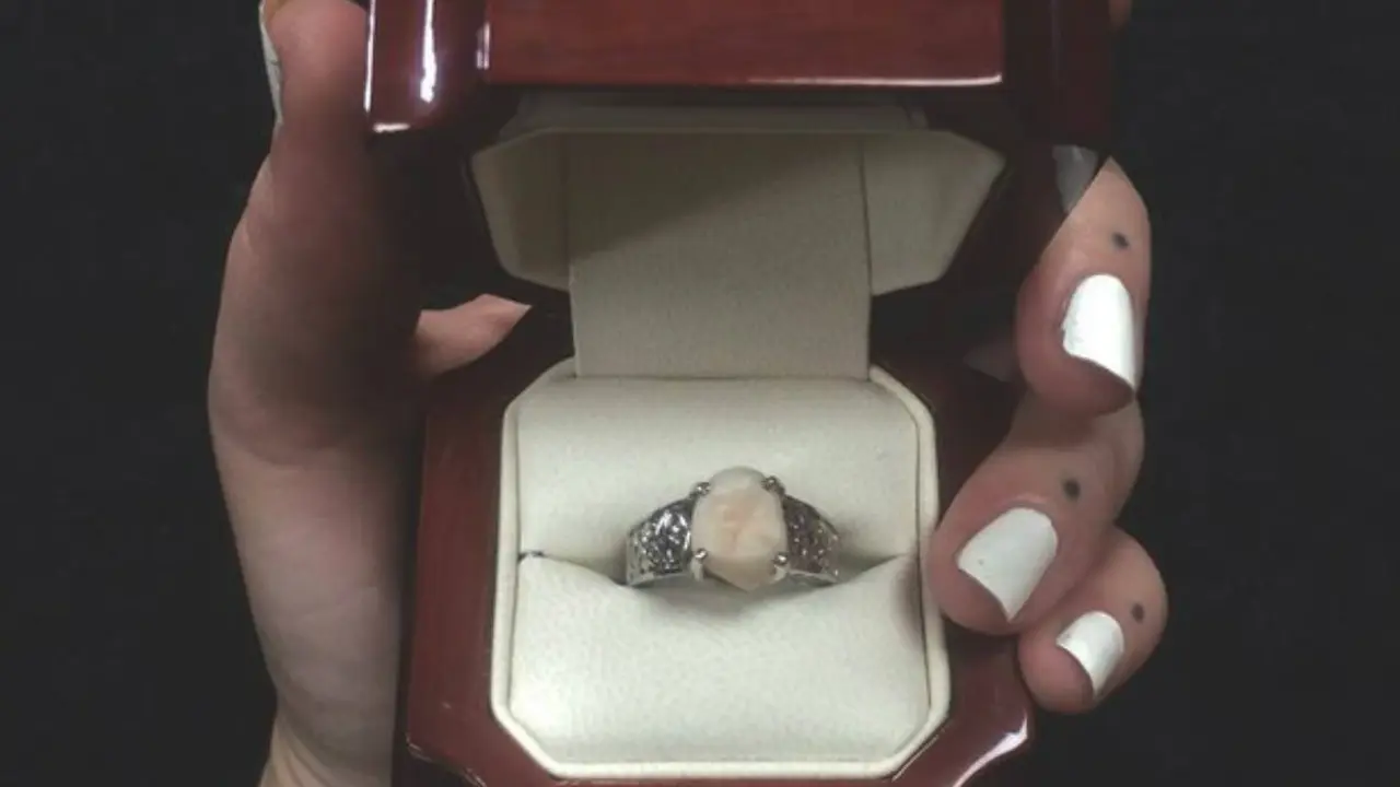 Cincin Tunangan Wanita Ini Terbuat dari Gigi Calon Suami