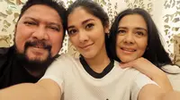 Hubungan baik setelah tak jadi suami istri juga ditunjukkan artis senior Lidya Kandou dan Jamal Mirdad. Pasangan yang membina rumah tangga selama 27 tahun itu kandas setelah Lydia mengajukan gugatan cerai. (Instagram/naymirdad)