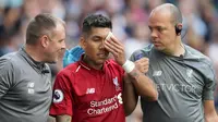 Penyerang Liverpool, Roberto Firmino, mengalami cedera mata saat timnya menang 2-1 atas Tottenham Hotspur pada laga pekan kelima Premier League, Sabtu (15/9/2018) malam WIB. (AP Photo/Tim Ireland)