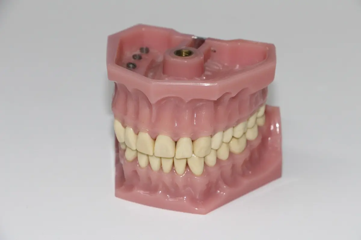 Mengenal Gingivitis atau Radang Gusi, Gejala, Penyebab, hingga Penanganannya