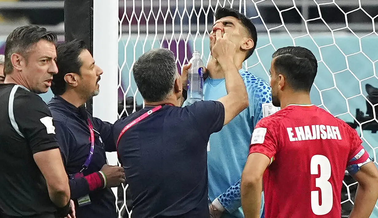 Wajah Beiranvand yang berbenturan dengan wajah Hosseini mengakibatkan hidung sang kiper patah dan mengeluarkan darah. (AP/Martin Meissner)
