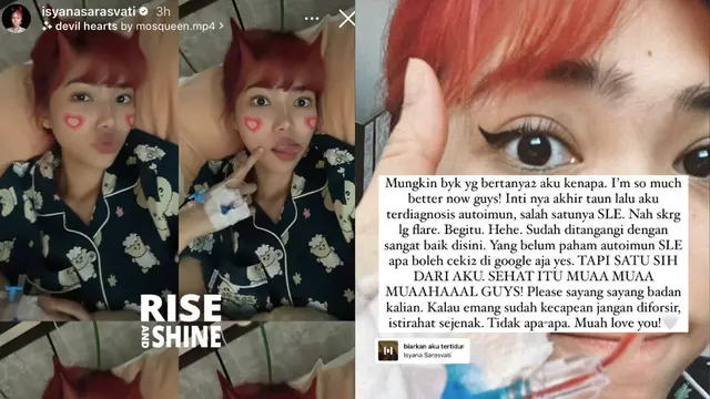 Isyana Sarasvati bagikan kabar terbaru soal kondisi kesehatannya. Dirinya didiagnosis terkena Autoimun SLE atau lupus.