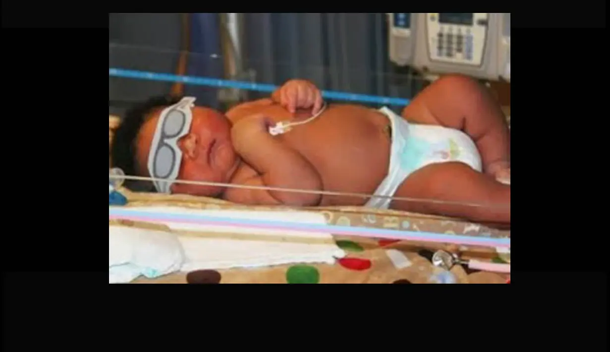 Bayi JaMichael adalah bayi terberat (7,257 kg) yang lahir di Rumah Sakit Good Shepherd di Longview, Texas pada 2011 silam. (Istimewa)