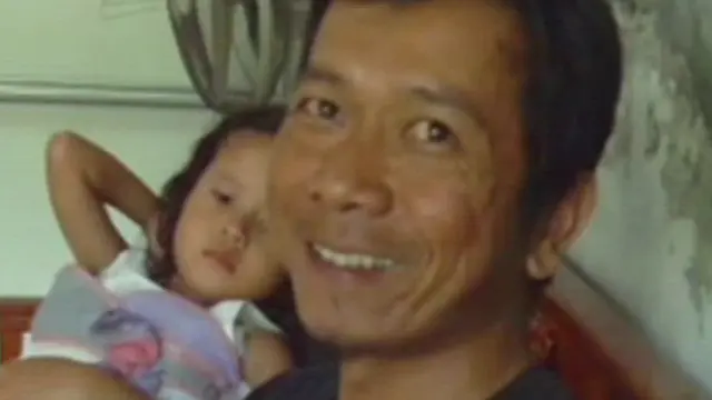 Perut Bocah 4 Tahun Membuncit, Diduga Tumor
