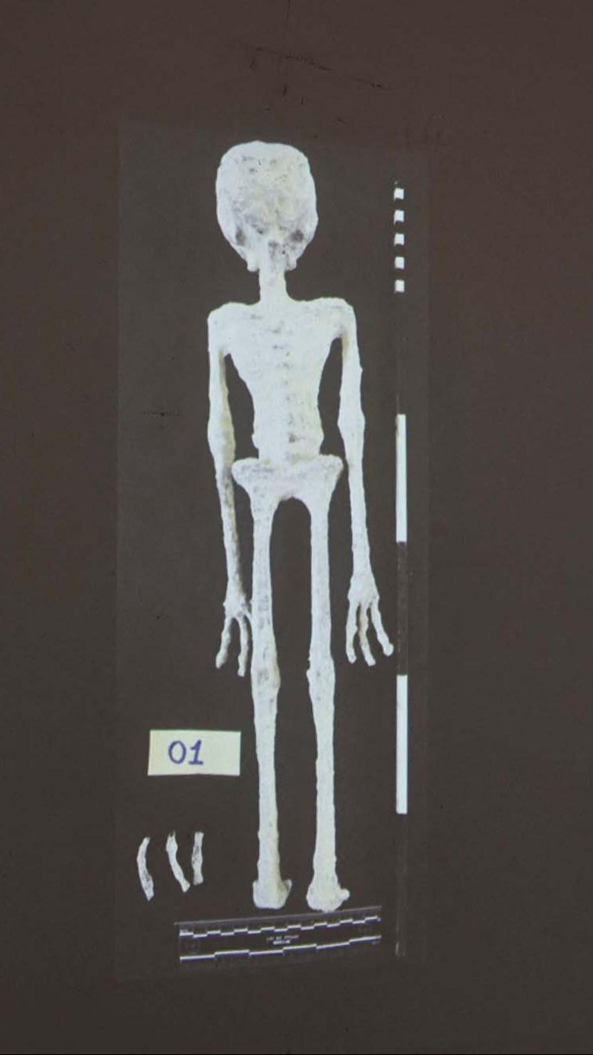 Temuan fakta baru terkait mumi alien misterius itu diungkap oleh&nbsp;Flavio Estrada, seorang arkeolog forensik di Institute of Legal Medicine of Peru, pada Jumat (12/1/2023).