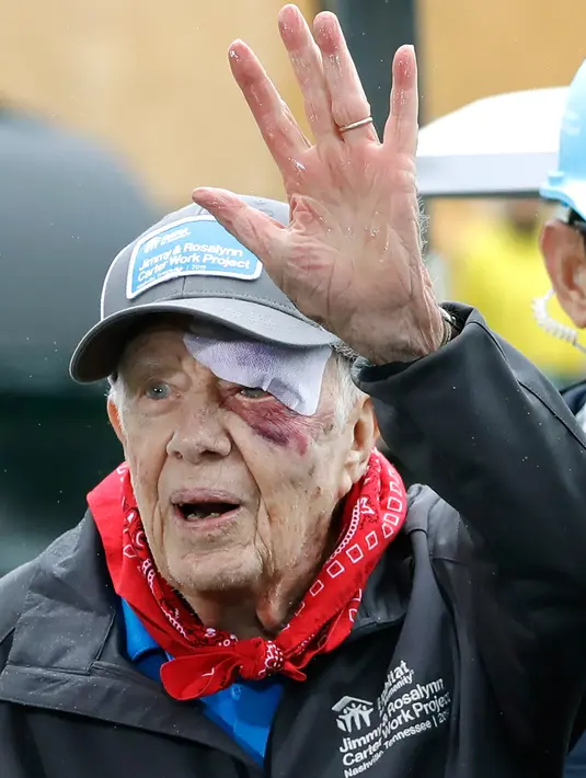 Mantan Presiden AS, Jimmy Carter setibanya paad acara yang digelar Habitat for Humanity di Nashville, Tennessee, Senin (7/10/2019). Tampil di depan publik, mata kiri pria 95 tahun itu memar dan mendapat beberapa jahitan di alis bagian atas setelah terjatuh di rumahnya di Georgia. (AP/Mark Humphrey)