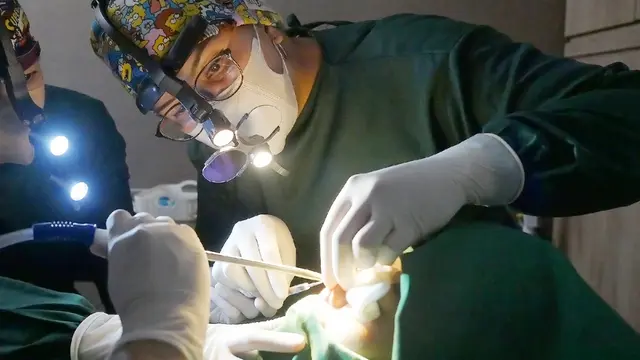 Rhinoplasty