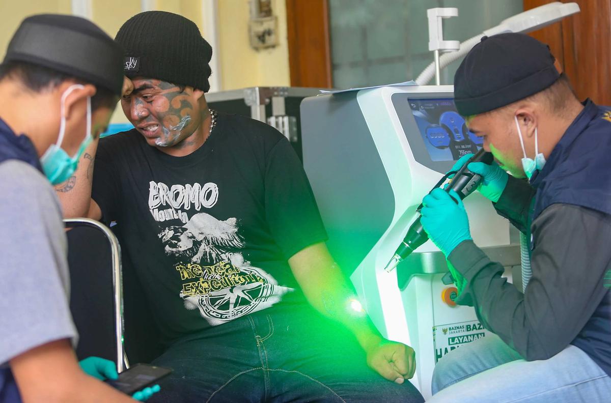 FOTO: Layanan Hapus Tato Gratis Sambut Ramadhan di Jakarta