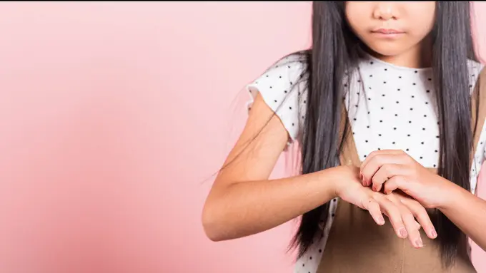 Probiotik dapat Mencegah Eksim Pada Anak-anak