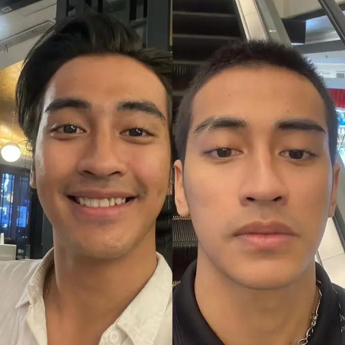 Rambut Abidzar menjadi cepak