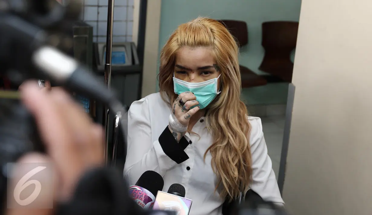 Aktris peran Sheila Marcia menjawab pertanyaan awak media sebelum meninggalkan Rumah Sakit Medistra, Jakarta, Selasa (9/5). Mengenakan masker, Sheila Marcia dibantu kursi roda saat berjalan menuju mobil. (Liputan6.com/Herman Zakharia)