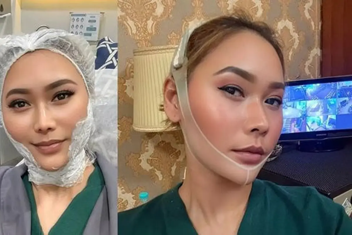 Rahasia Wajah Tirus dan Awet Muda Ala Inul Daratista. (instagram/inul.d)