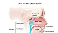 Kanker ini biasa terjadi di daerah sekitar rongga mulut, faring, laring, rongga hidung, sinus paranasal, tiroid dan kelenjar ludah.