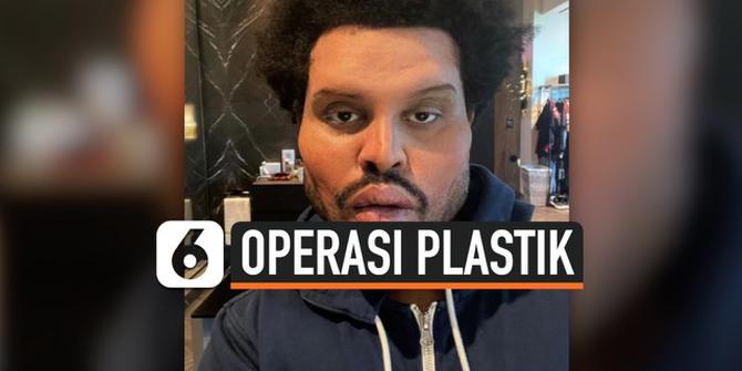 VIDEO: Viral Wajah Baru The Weeknd di Video Klip Teranyar Disebut Oplas Gagal