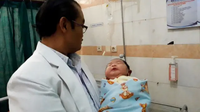 Bayi jumbo alias bayi raksasa seberat 5,7 kilogram lahir di Cilacap dengan persalinan normal, Minggu siang (16/9/2018). (Liputan6.com/Muhamad Ridlo)
