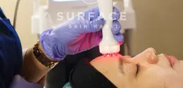 Cara Mengencangkan Kulit Wajah dengan H2O Facial di Klinik Kecantikan.&nbsp; foto: istimewa