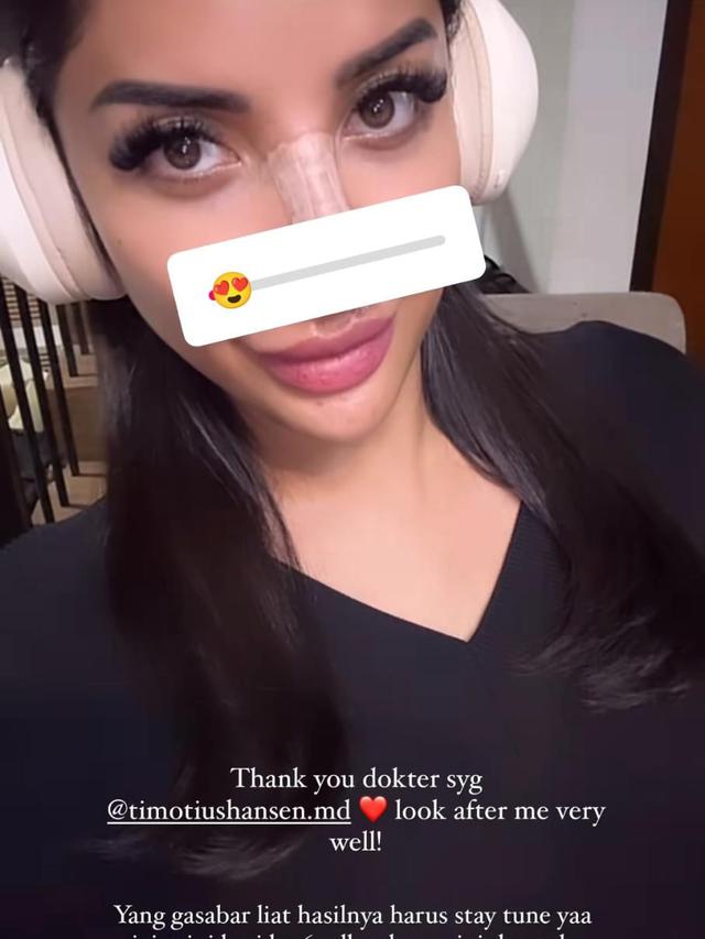 Millen Cyrus Mau Rombak Hidung Lagi. (instagram/millencyrus)