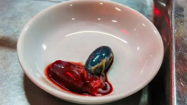 Jantung Kobra