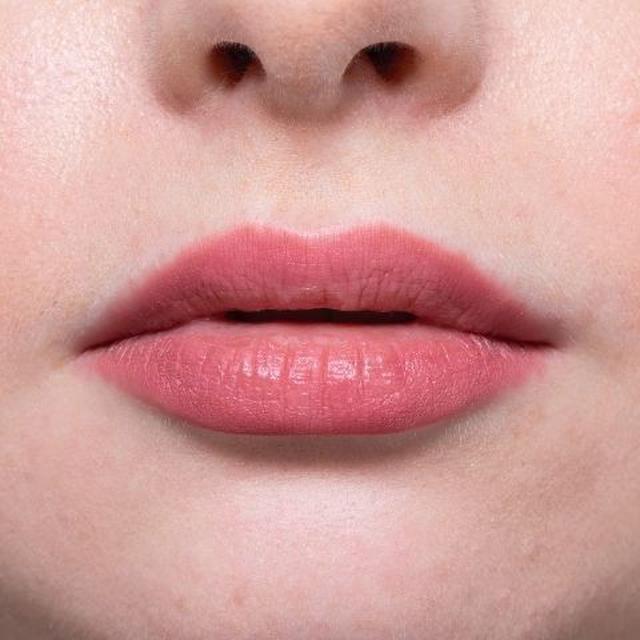 Bibir Tipis dan Simetris